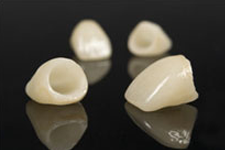 Porcelain Crowns