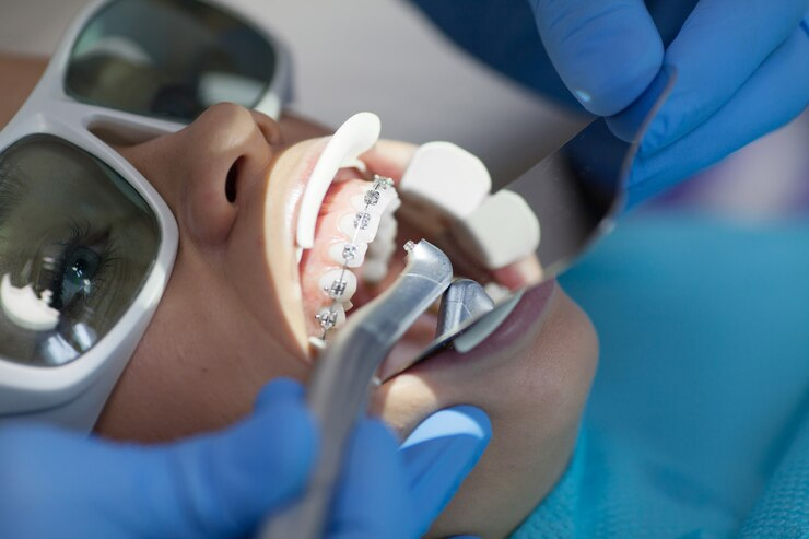 Laser Gum Color Change