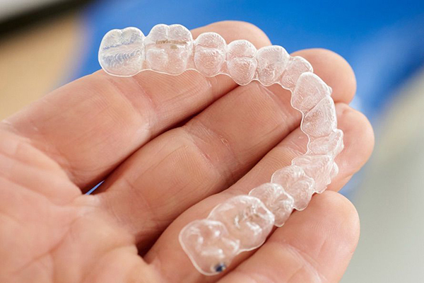 dental braces