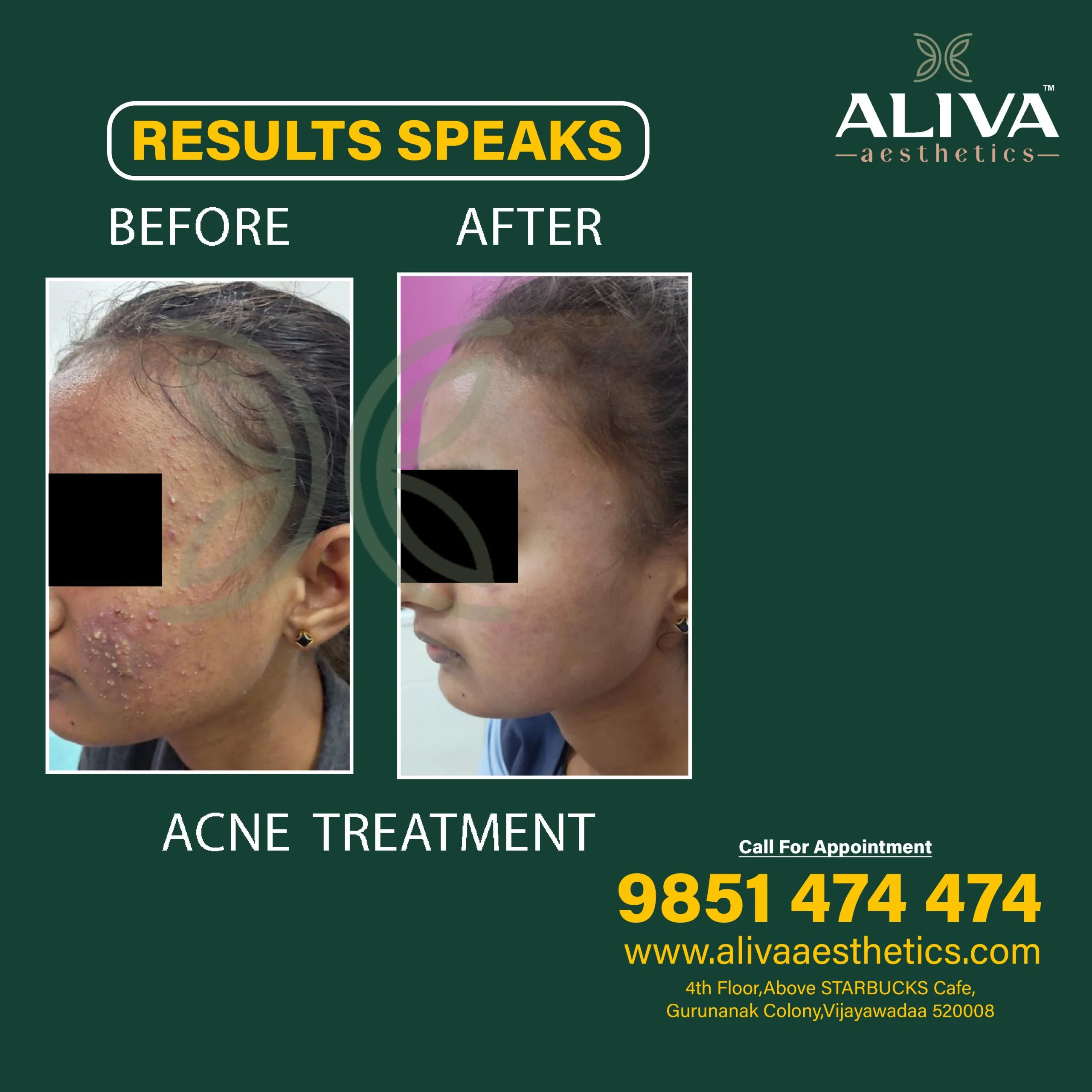 Before and after result 1