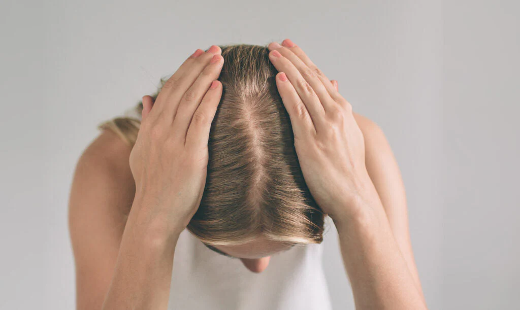 Crown and vertex thinning hair regrowth treatment