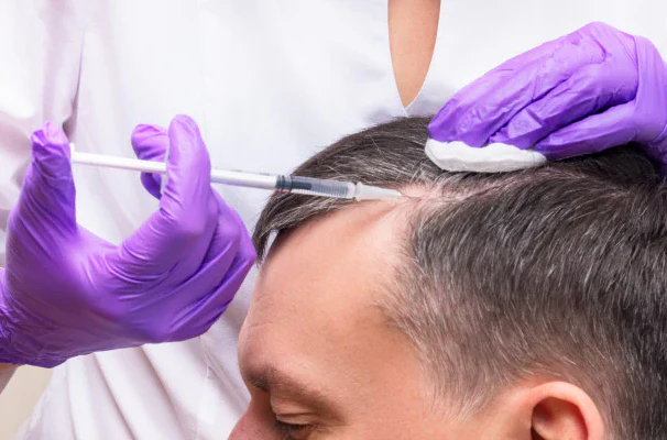 Understanding hair loss treatment at Aliva Aesthetics