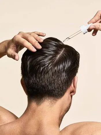 Minoxidil topical therapy hair