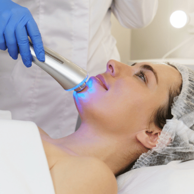 Narrow-Band UVB Phototherapy — Vitiligo at Aliva Aesthetics