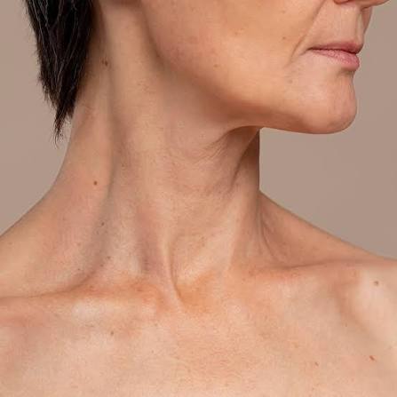Neck and decolletage ageing
