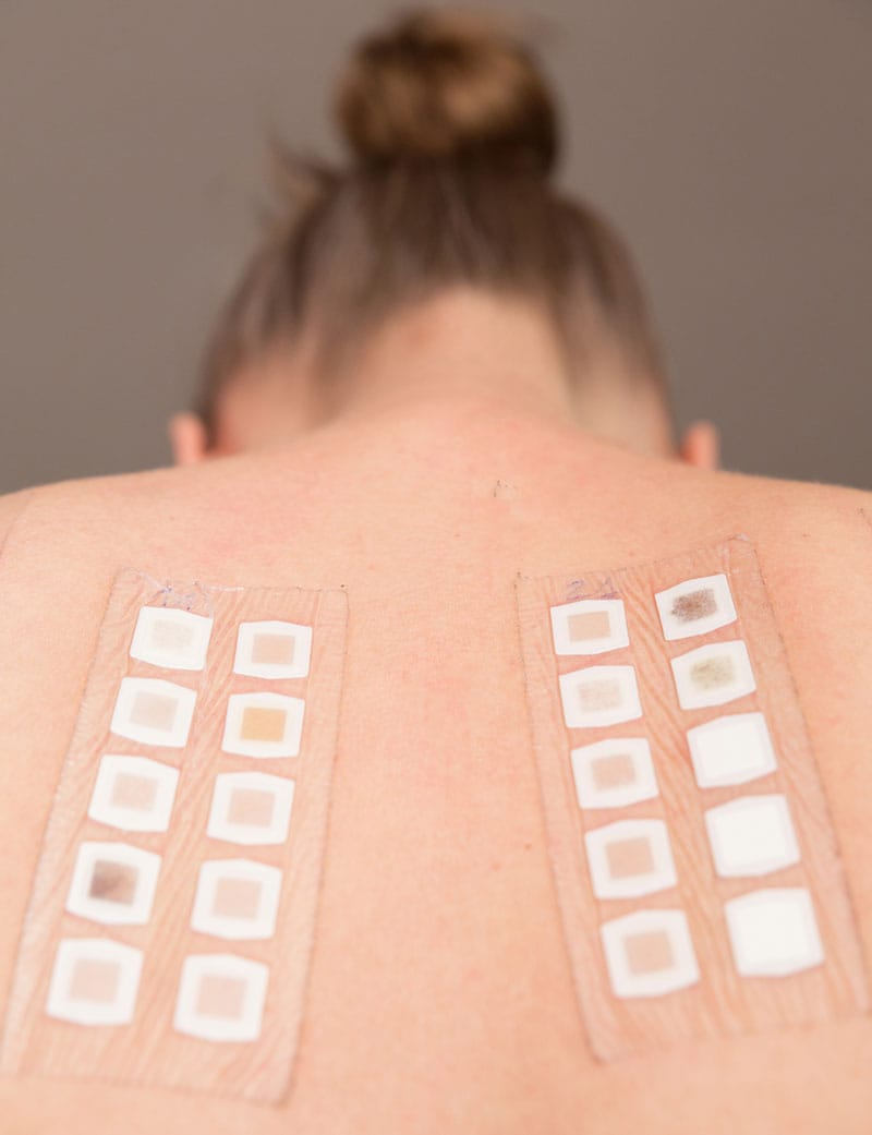 Patch & Allergy Testing — Skin Allergies & Rashes at Aliva Aesthetics