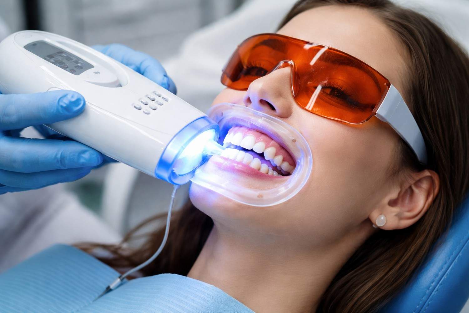 Professional teeth whitening cosmetic