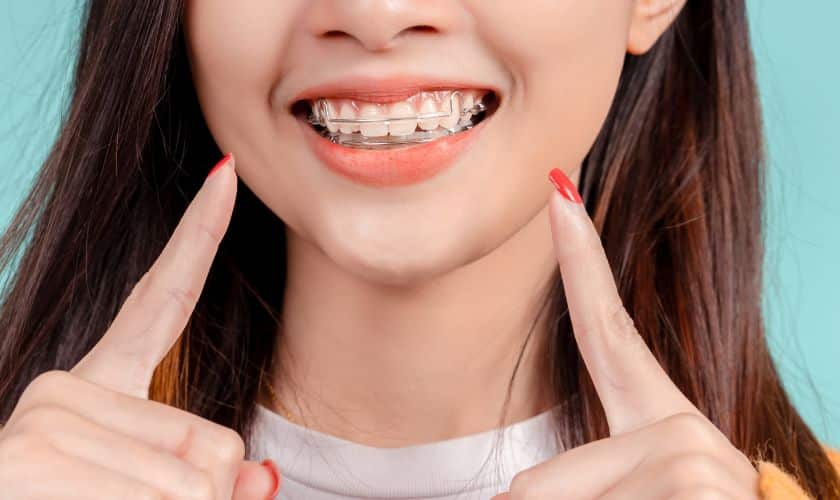 Retainers after braces dental