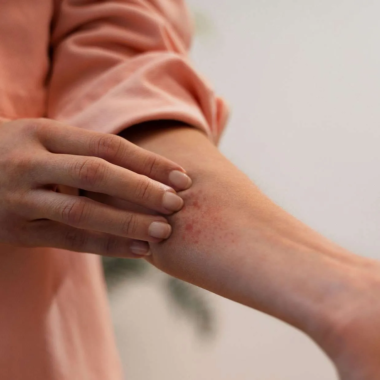 Skin Allergies & Rashes consultation at Aliva Aesthetics