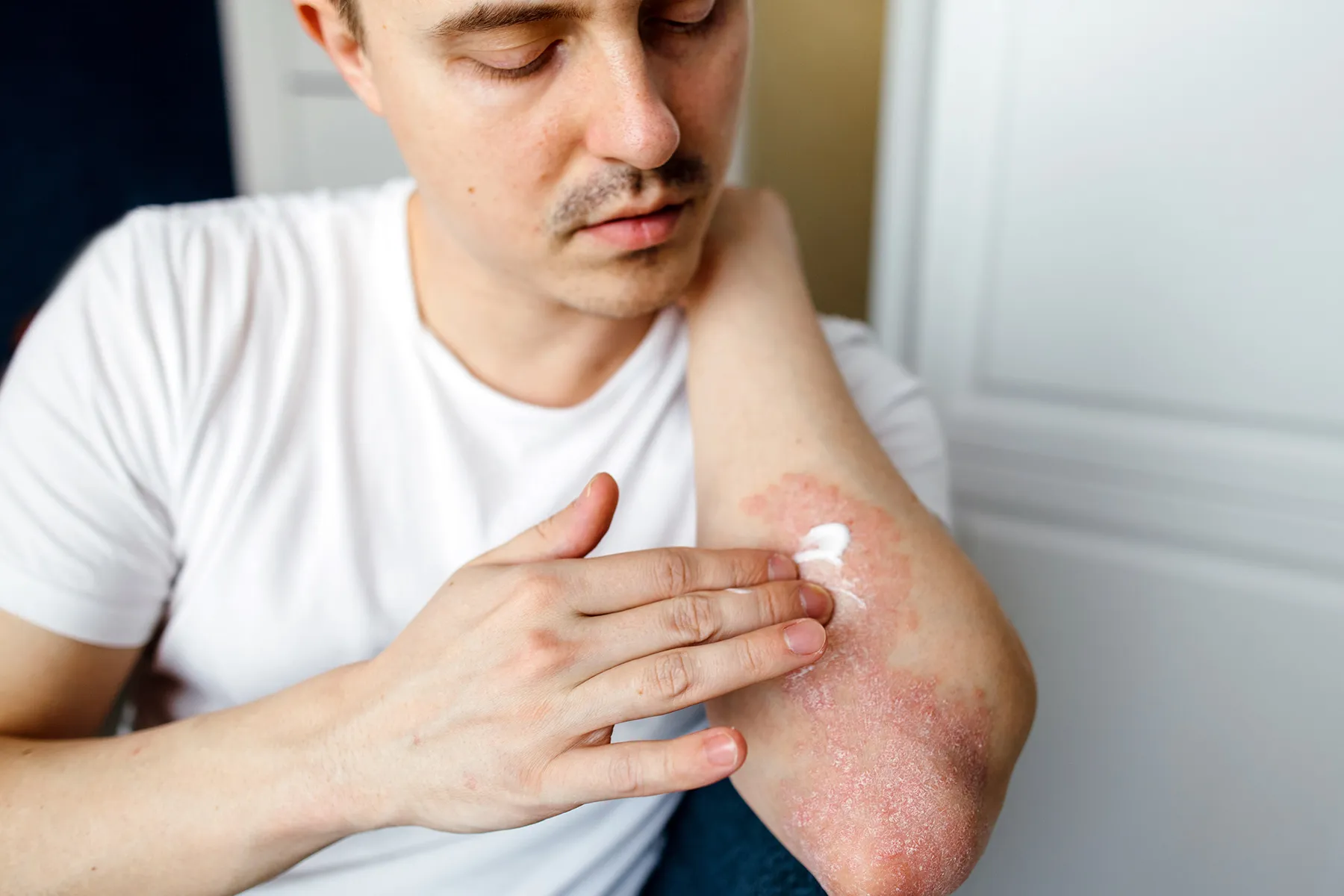 Targeted Topical Protocols — Skin Allergies & Rashes at Aliva Aesthetics