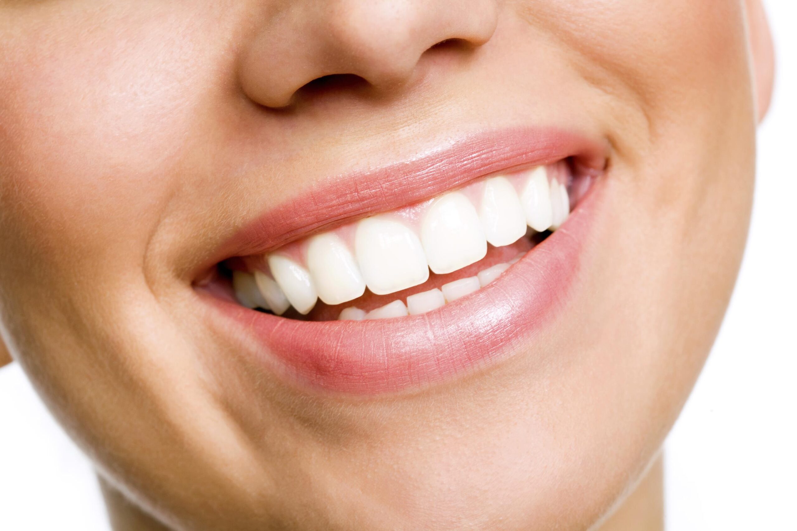 Teeth whitening smile design